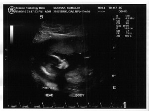 Our Baby!! OUR BABY!!